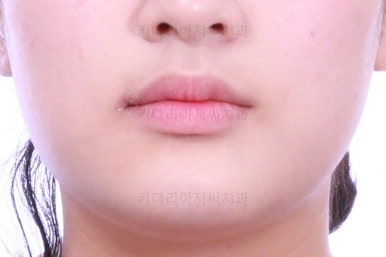 부산교정치과추천