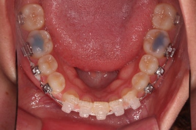 부산교정치과추천