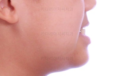 부산어린이교정
