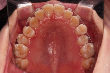 부산치아교정잘하는치과