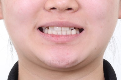 연산동교정치과