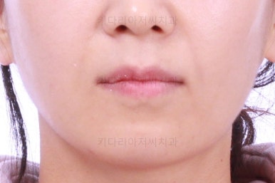 부산인비절라인