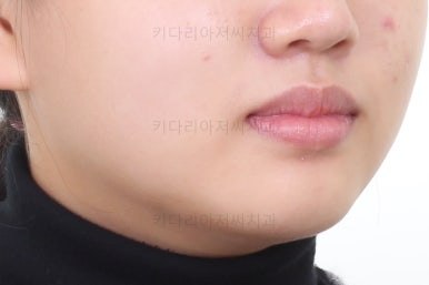 부산교정전문의