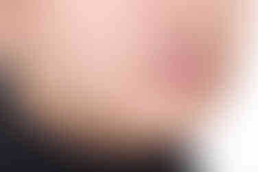 부산교정전문의