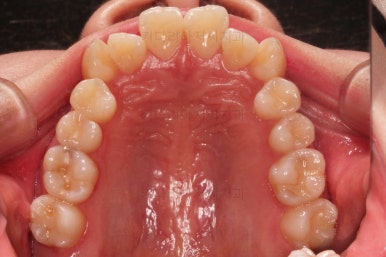 부산교정전문의