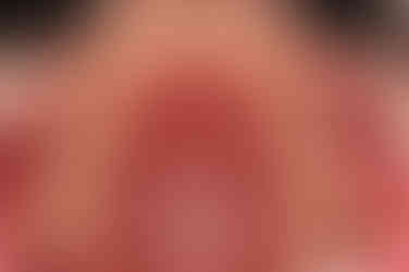 부산교정전문의