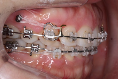 부산연산동교정치과