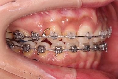 연산동교정치과