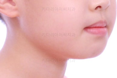 부산어린이교정