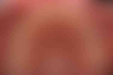 부산연산동교정치과