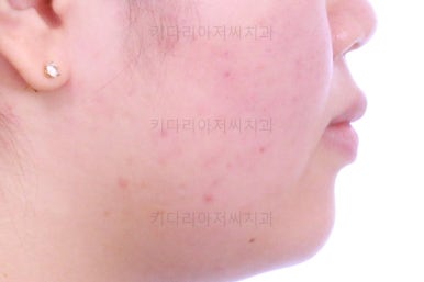 부산치아교정치과