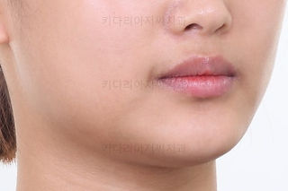 부산교정치과추천
