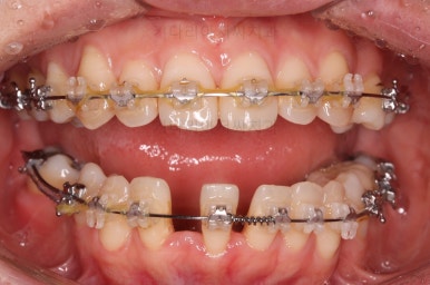 부산재교정치과