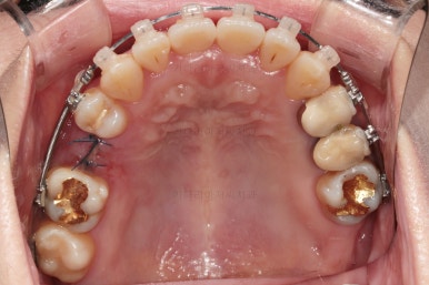 부산연산동치과