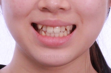 부산치과