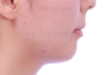 부산무턱교정치과