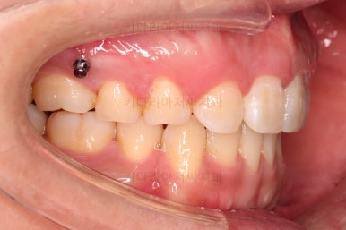 연산동교정치과