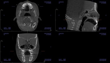 부산어린이교정