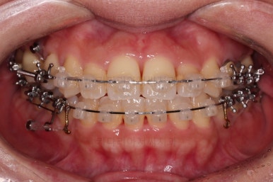 부산연산동치과