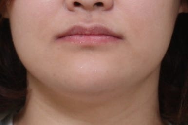 부산치아교정치과