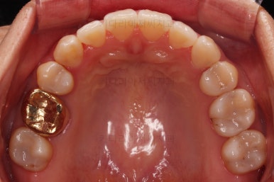부산인비절라인
