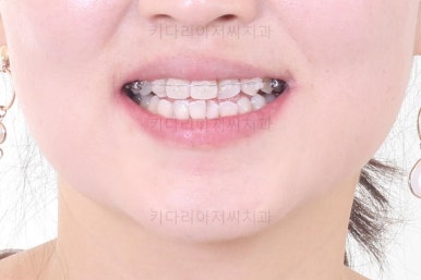 연산동교정치과