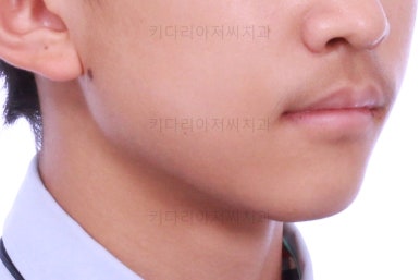 부산교정치과추천