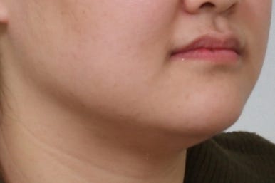 부산치아교정치과