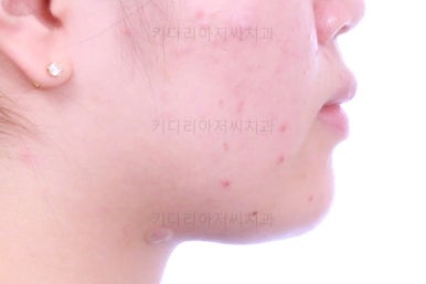 부산치아교정치과
