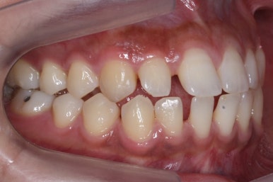 부산치아교정치과