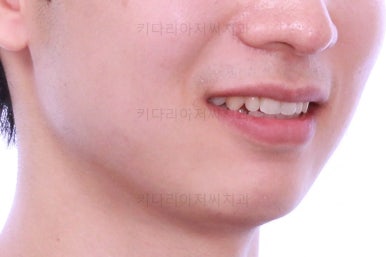 부산연제구교정