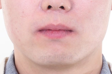 부산교정치과