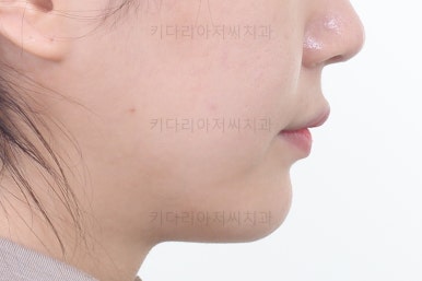 연산동교정치과