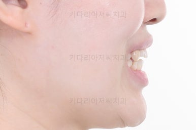 부산교정치과
