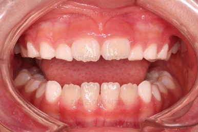 부산어린이교정