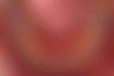 부산구순구개열