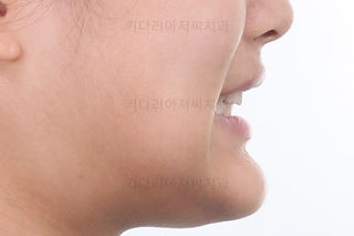 부산교정치과추천