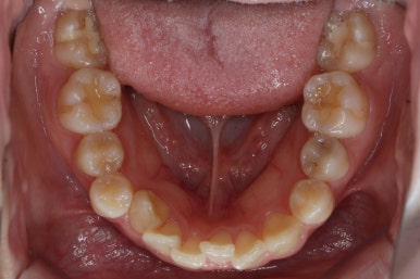 연산동교정치과