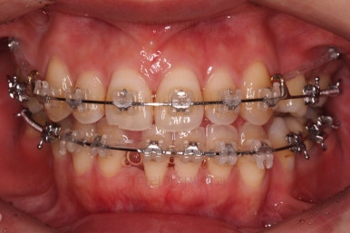부산재교정치과