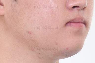 연산동교정