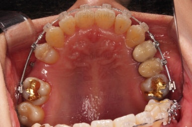 부산연산동치과