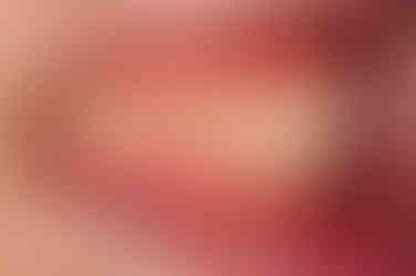 부산주걱턱교정