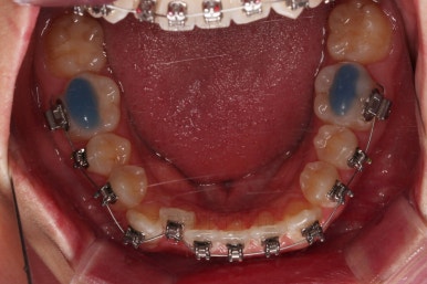 부산치아교정치과