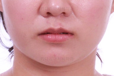 부산치아교정치과
