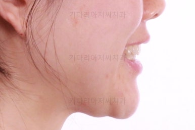 부산인비절라인