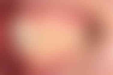 부산치아교정잘하는곳