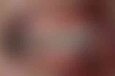 부산연산동교정치과