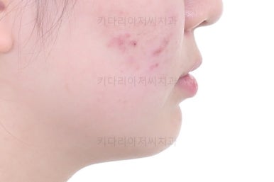 부산치아교정잘하는곳