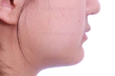 부산청소년교정치과