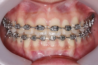 부산연산동청소년교정